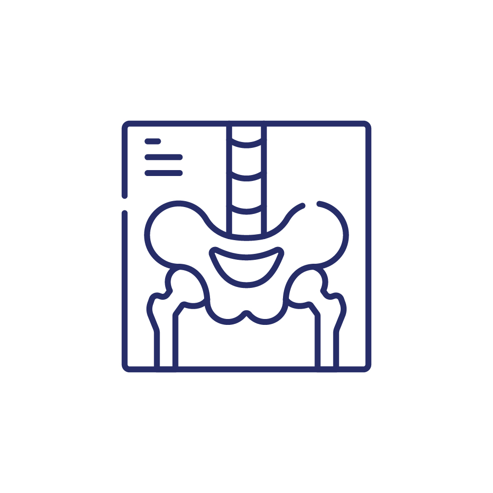 X-ray test, also known as radiography