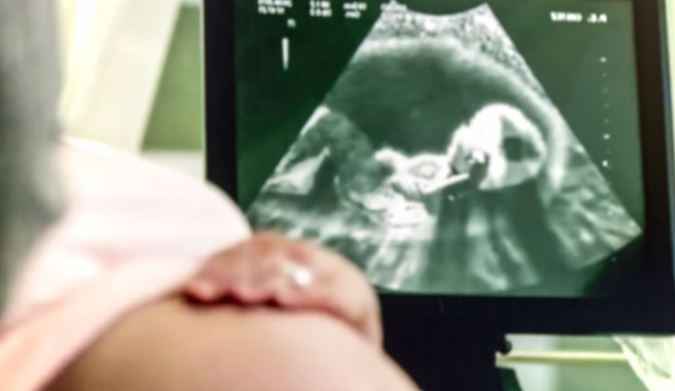 pregnancy ultrasound is a medical imaging technique