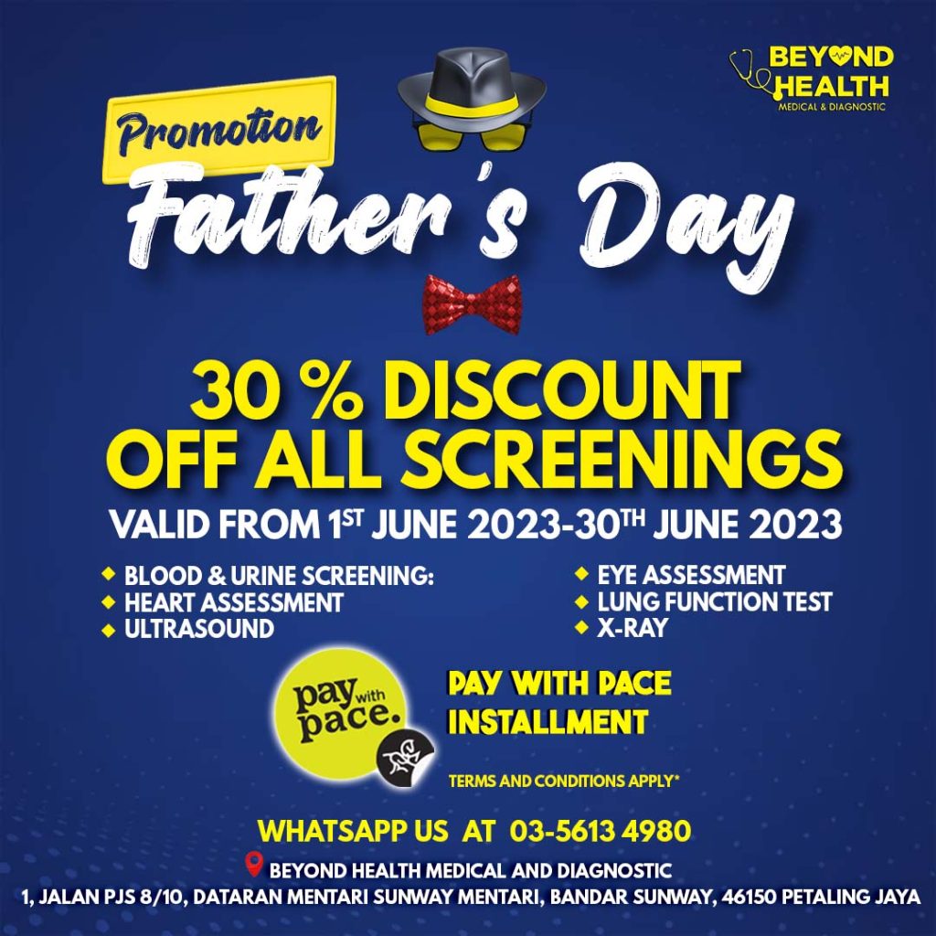 30% discount of all screenings