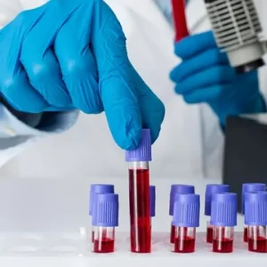 Blood tests can be used to track your progress