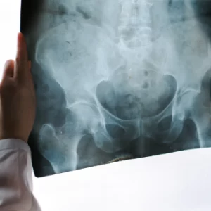 pelvic X-ray is a medical imaging procedure