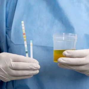 Urine microalbumin is tested to help detect early kidney damage